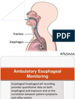 Ambulatory Esophageal Monitoring