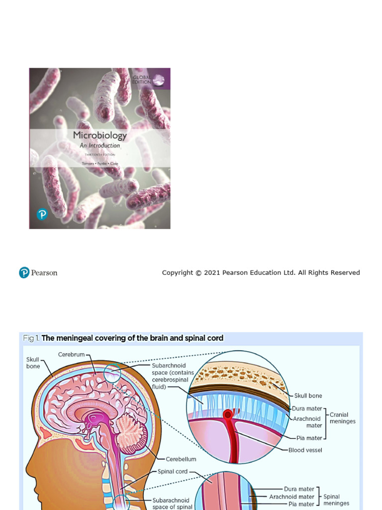 Ch_22_Microbial Diseases of the Nervous System Sum_250612_165102 | PDF ...