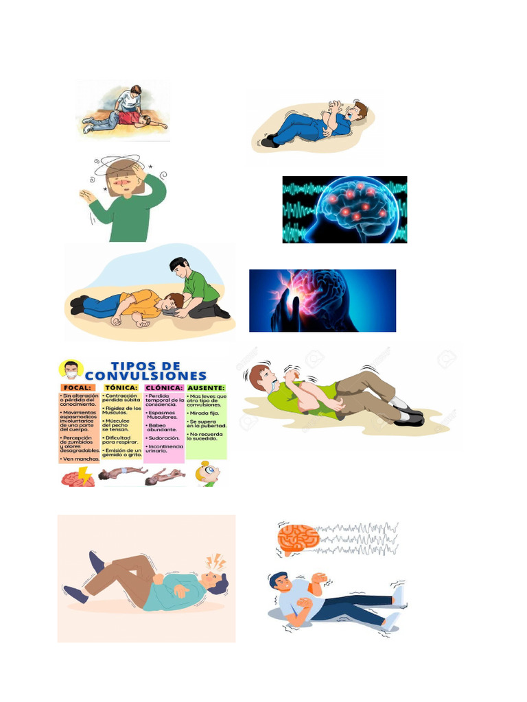Convulsion Es | PDF