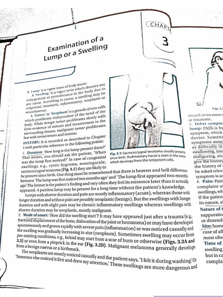 Swelling | PDF