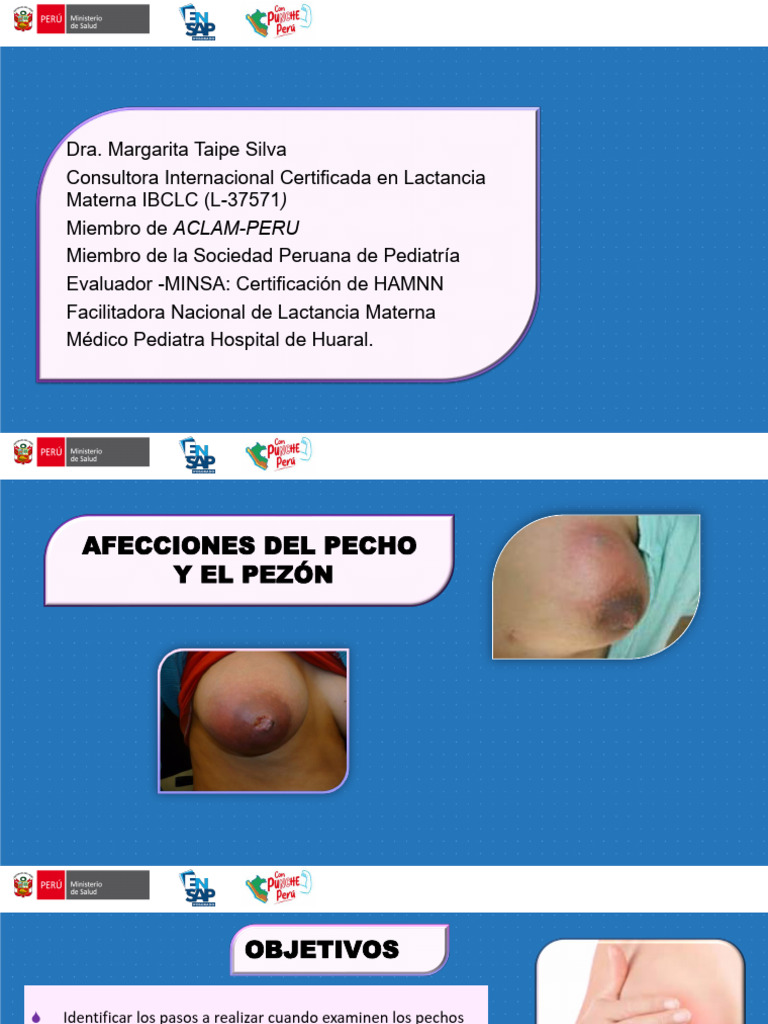AFECCIONES DEL PECHO Y PEZON | PDF | Pecho | Candidiasis