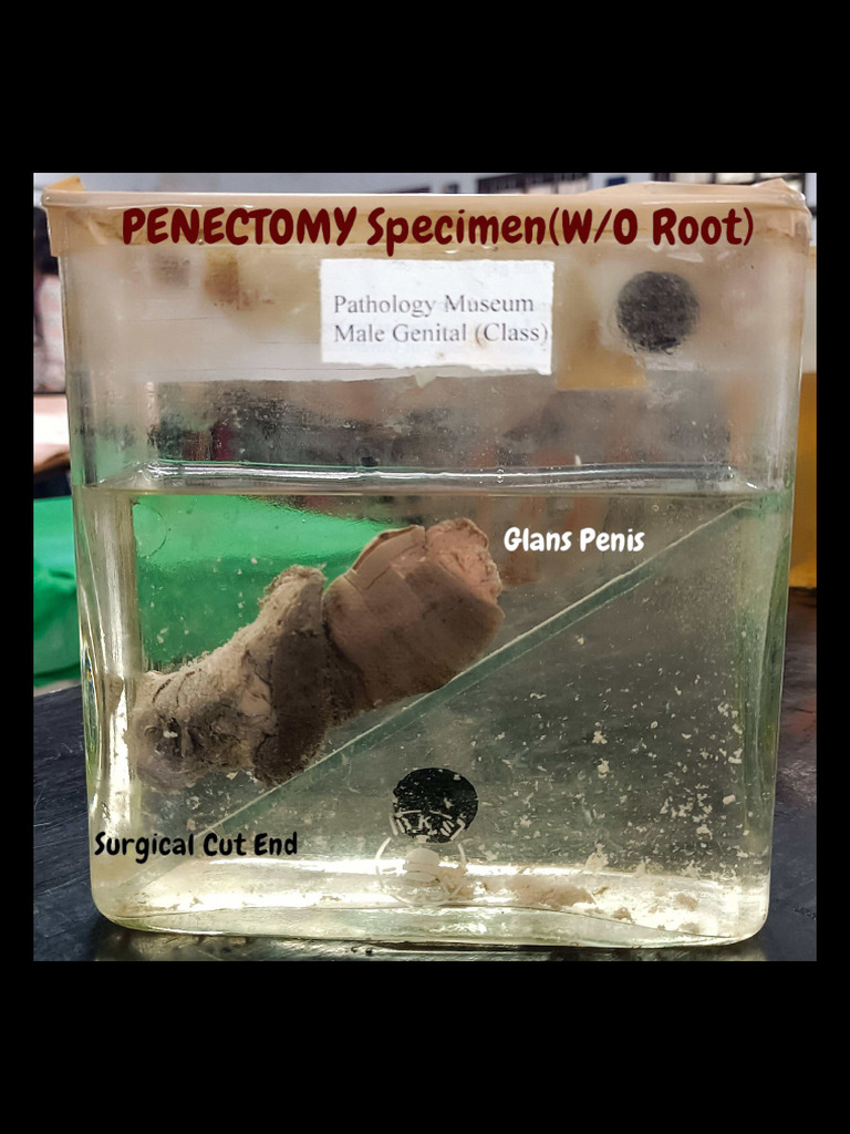 Gross Pathology Specimens | PDF | Mammal Reproductive System | Anatomy