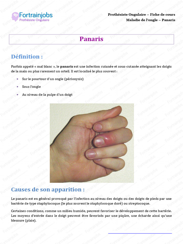 Maladies de L Ongle Panaris | PDF | Douleur | Inflammation