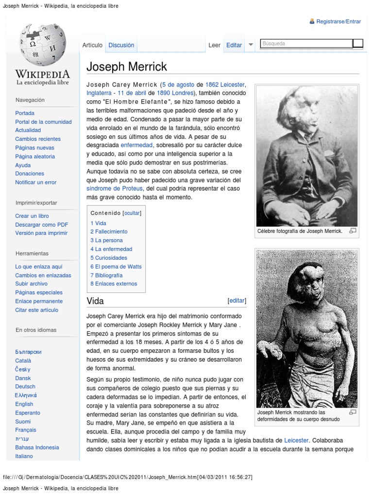 Vida de Joseph Merrick, el Hombre Elefante | PDF