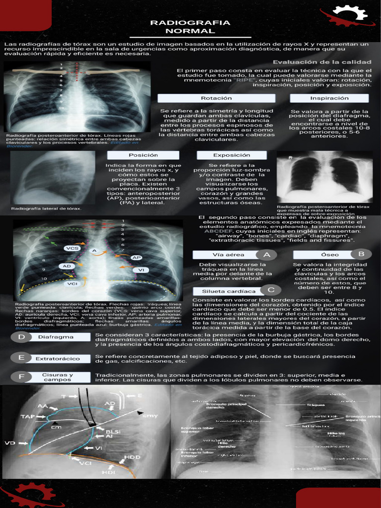 Radiografia Normal | PDF