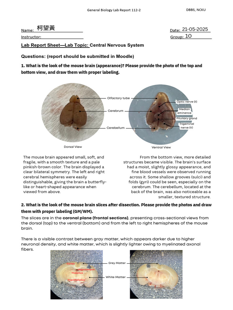 113 Lab Report c0a4b89eacadd8d1b55bc9a4cbd58842.PDF | PDF | Brain ...