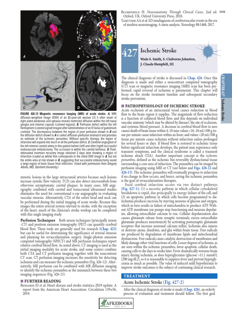 Ischemic Stroke | PDF | Stroke | Ischemia