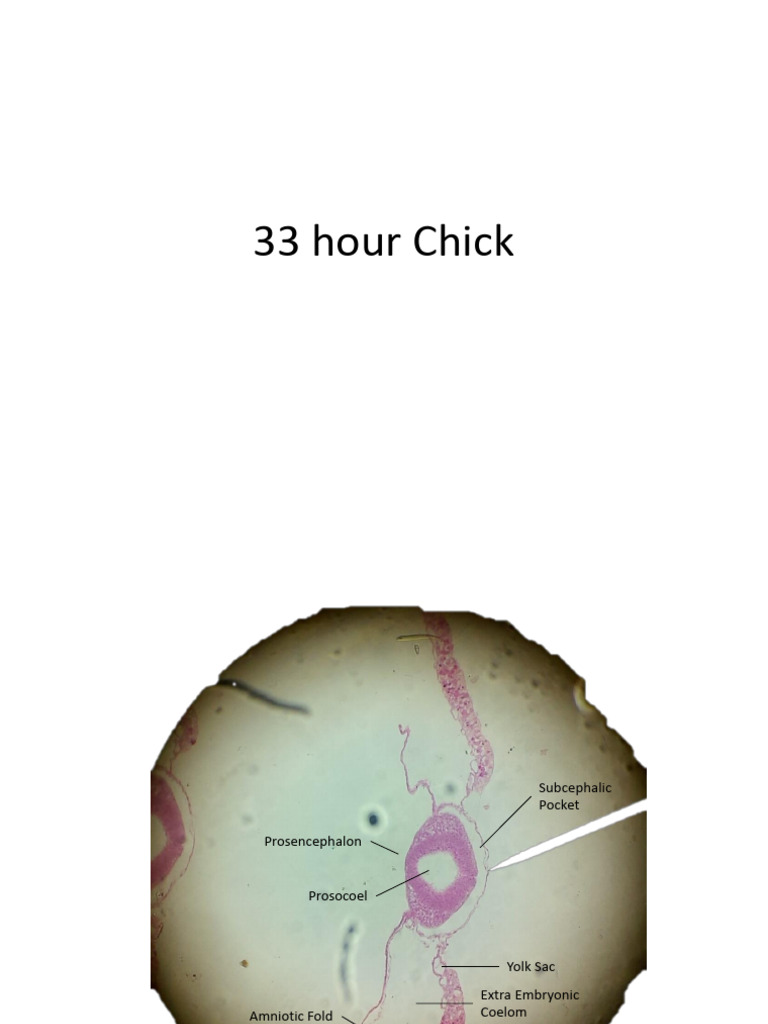 33 Hour Chick Embryo Transverse Section | PDF | Aorta | Anatomy