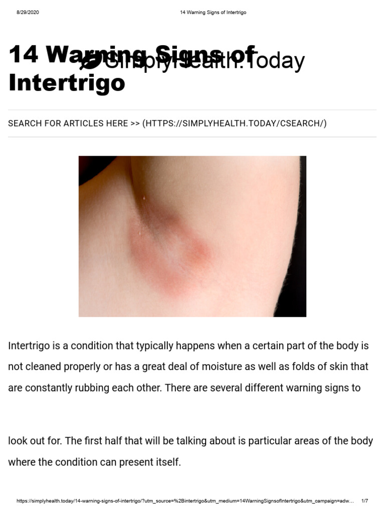 14 Warning Signs of Inter Trigo | PDF | Diseases And Disorders | Human ...