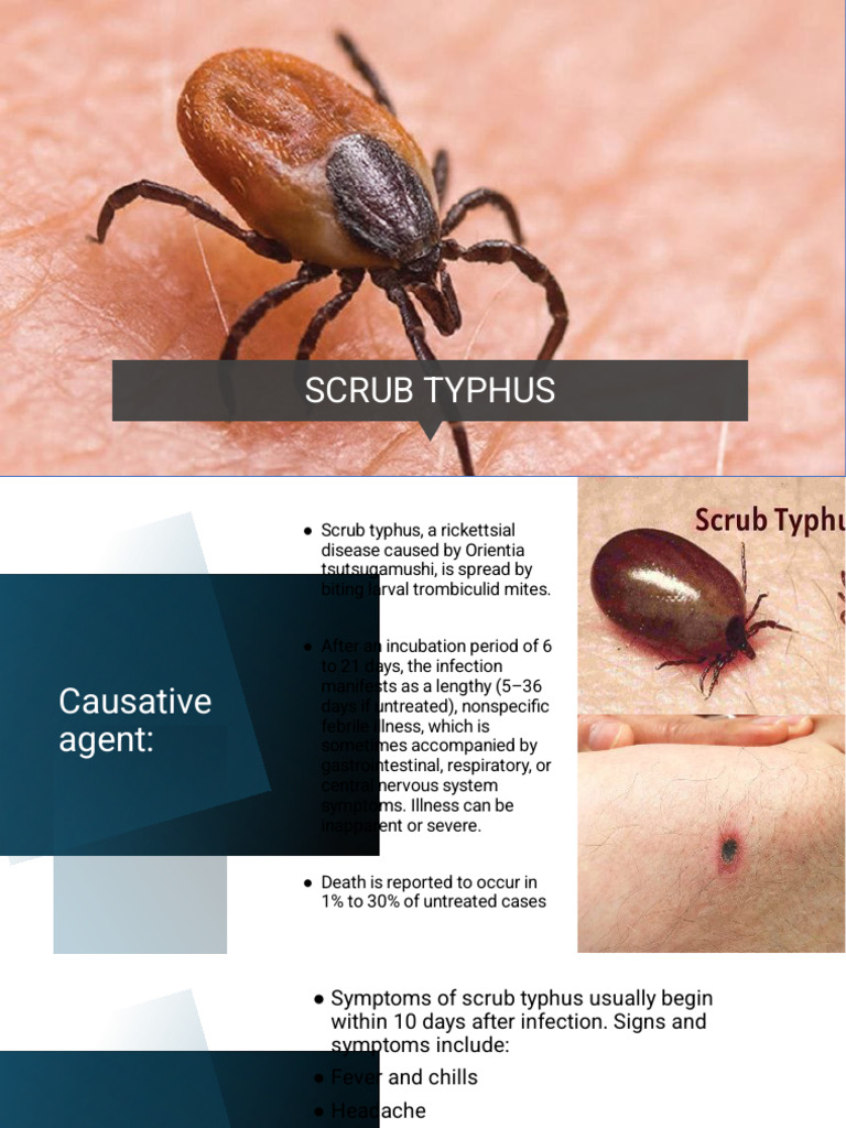 Scrub Typhus | PDF | Diseases And Disorders | Immunology