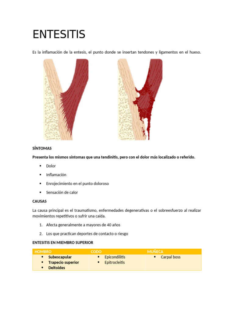 Entesitis | PDF