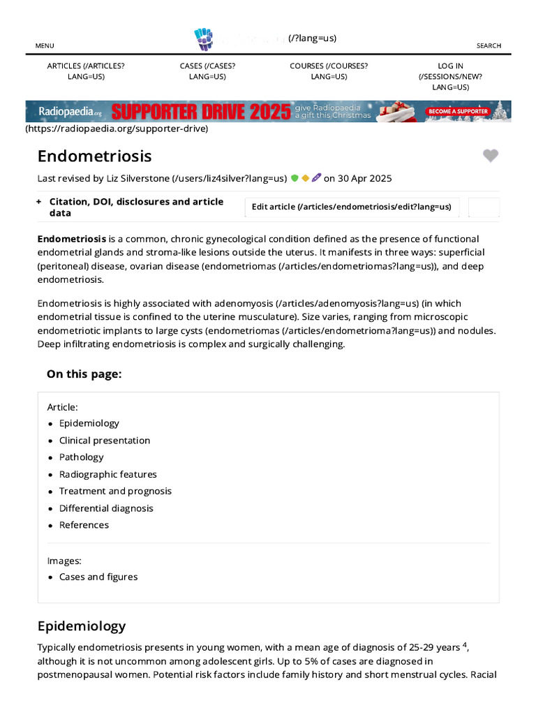 Endometriosis - Radiology Reference Article | PDF | Medical Specialties ...