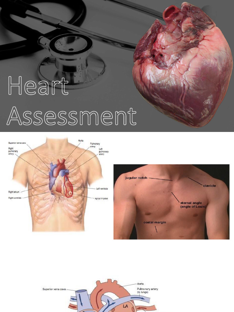 Assessment of The Heart | PDF | Heart Valve | Circulatory System