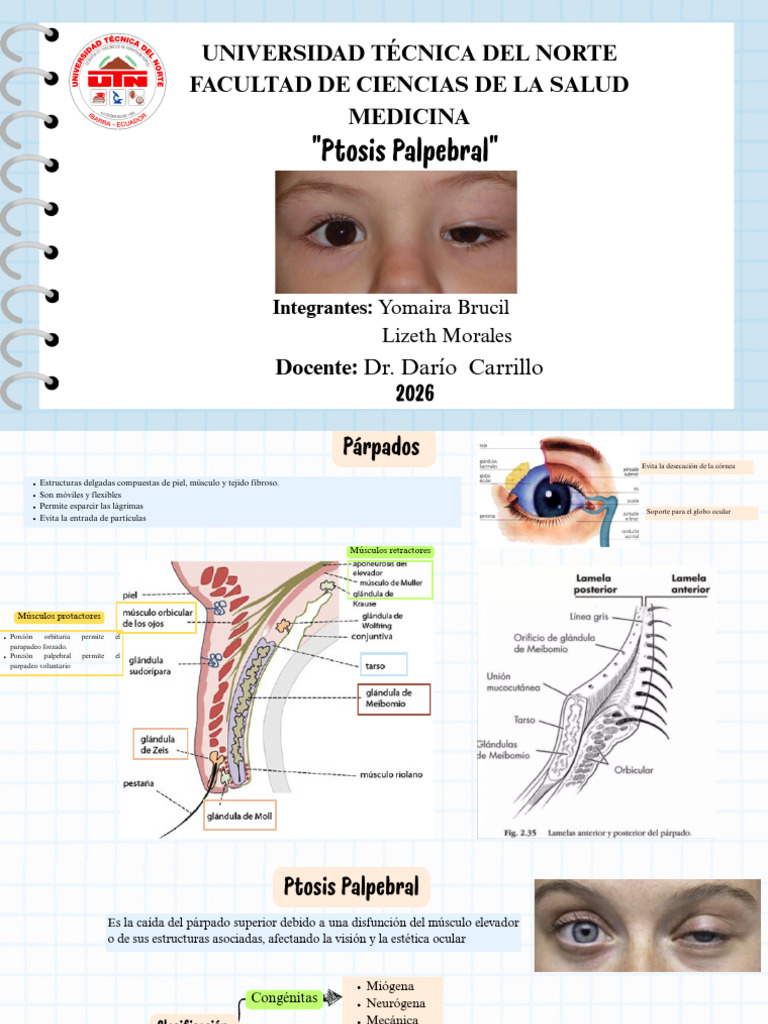 PTOSIS PALPEBRAL_GRUPO10 | PDF | Enfermedades y trastornos | Medicina ...