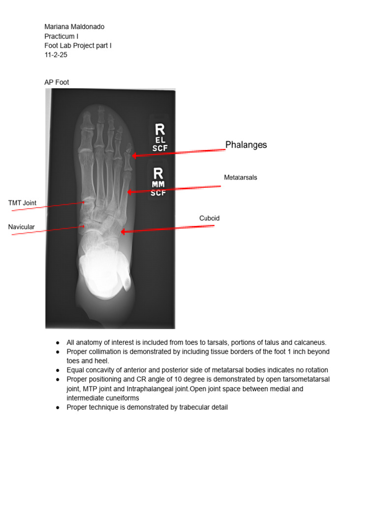 Foot Lab Project Part 1 | PDF | Foot | Ankle