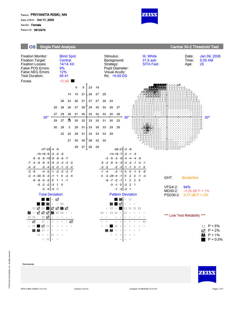 Single Field Analysis Central 30-2 Threshold Test | PDF