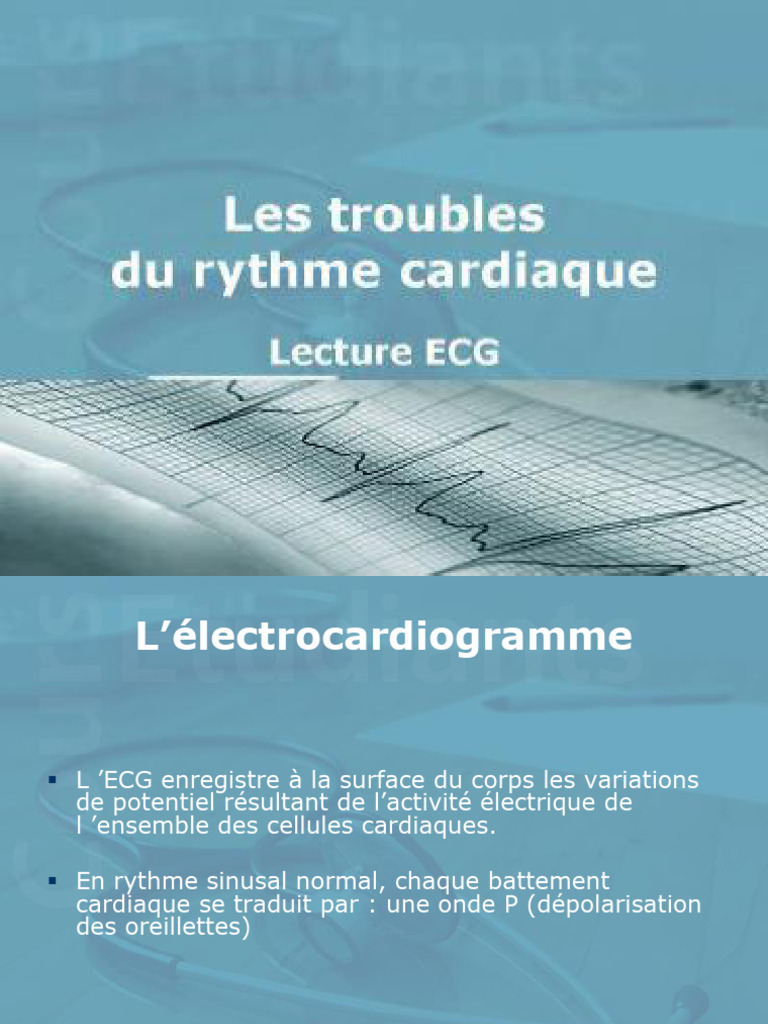 Les Troubles Du Rythme Cardiaque Lecture ECG | PDF ...