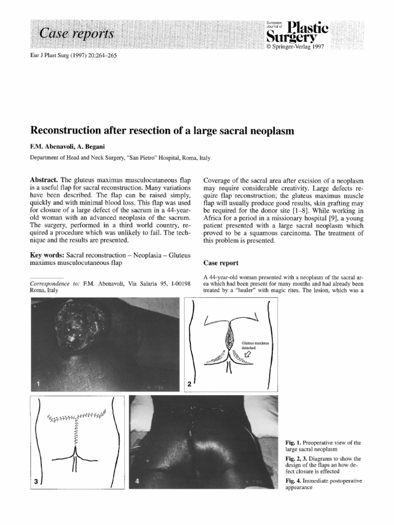 Reconstruction After Resection of a Large Sacral Neoplasm | PDF ...