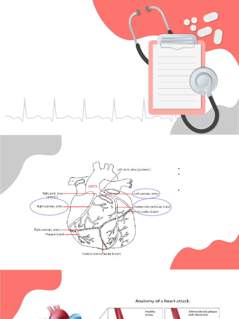 Cardiovascular Section+case | PDF | Myocardial Infarction | Heart