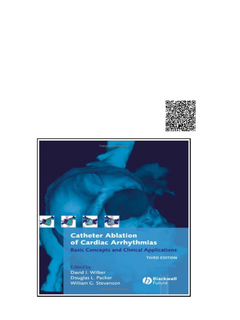 Catheter Ablation of Cardiac Arrhythmias Basic Concepts and Clinical ...