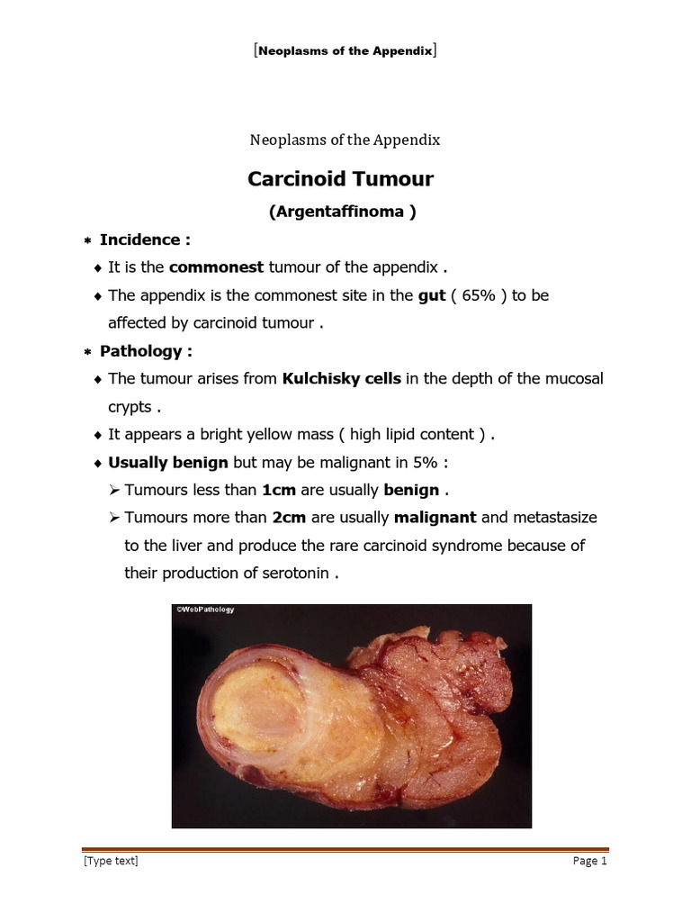 Neoplasms of The Appendix | PDF