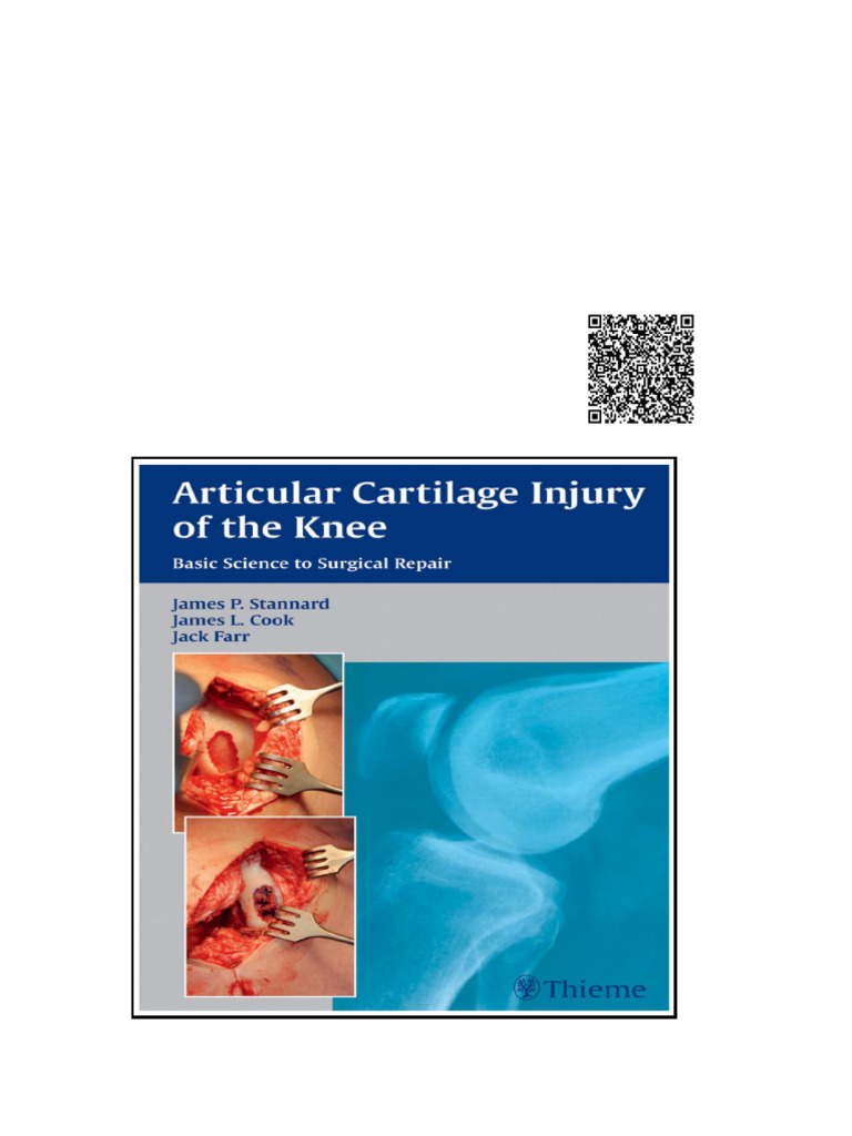 Articular Cartilage Injury of the Knee Basic Science to Surgical Repair ...