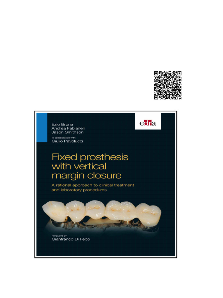 Fixed Prosthesis With Vertical Margin Closure | PDF