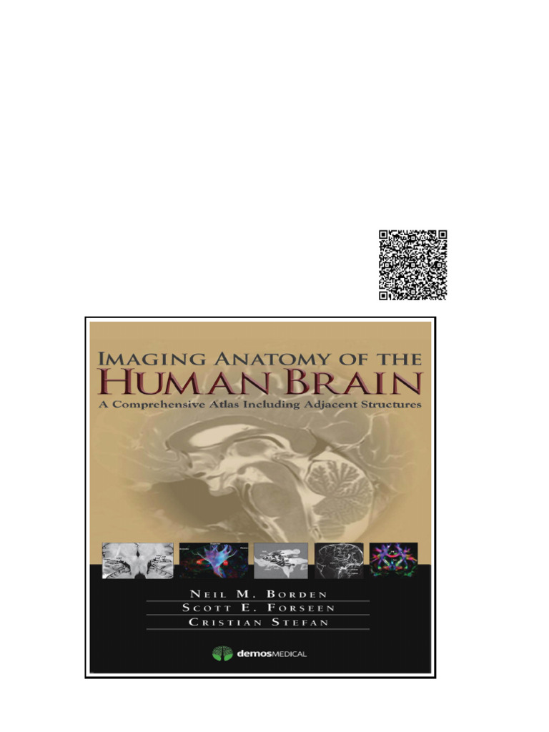 Imaging Anatomy of The Human Brain A Comprehensive Atlas Including ...