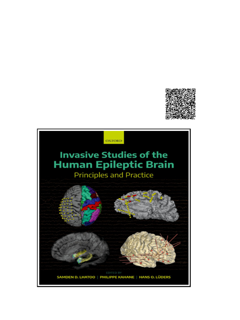 Invasive Studies of The Human Epileptic Brain Principles and Practice ...