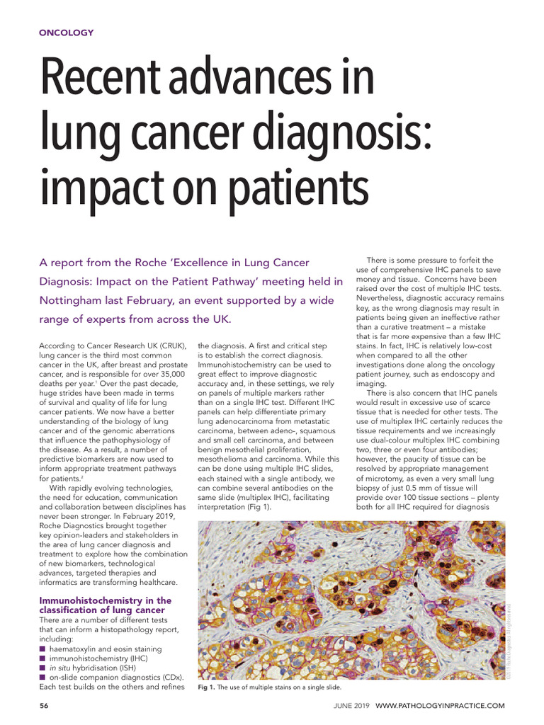 Recent advances in lung cancer diagnosis | PDF | Epidermal Growth ...