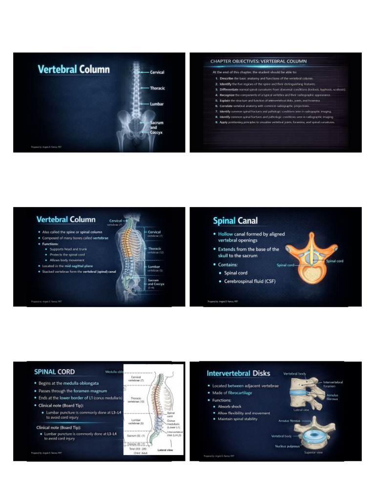 Full Vertebral Column | PDF | Scoliosis | Musculoskeletal System