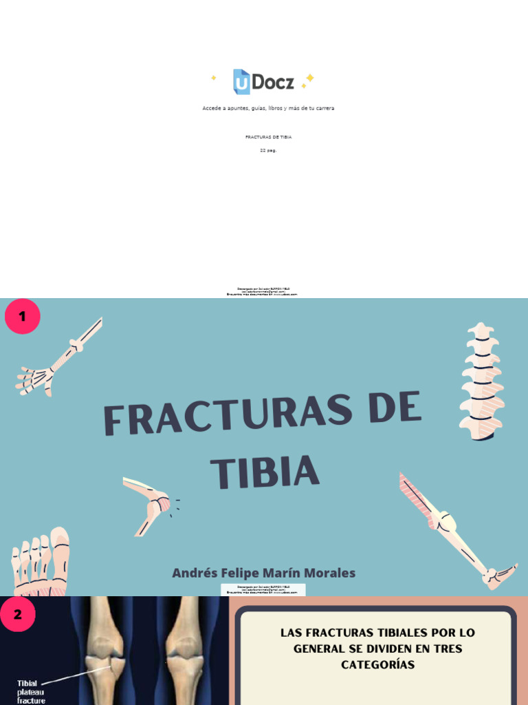Fracturas de Tibia 695873 Downloadable 3078080 (1) | PDF | Tobillo ...