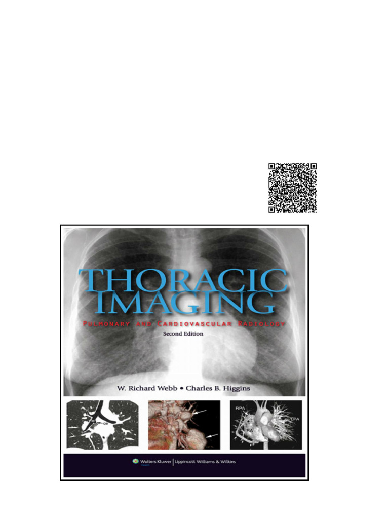 Thoracic Imaging Pulmonary and Cardiovascular Radiology (2nd Edition ...