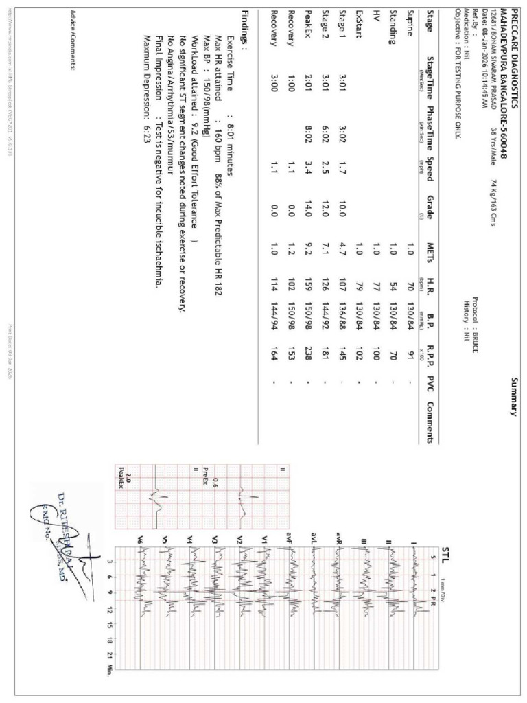 ECG TMT | PDF