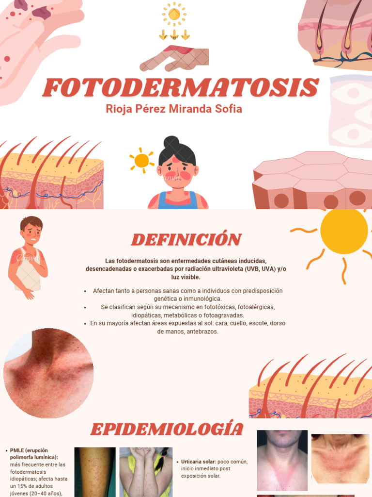 FOTODERMATOSIS | PDF | Inflamación | Sistema inmune