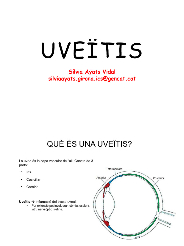 Uveïtis | PDF