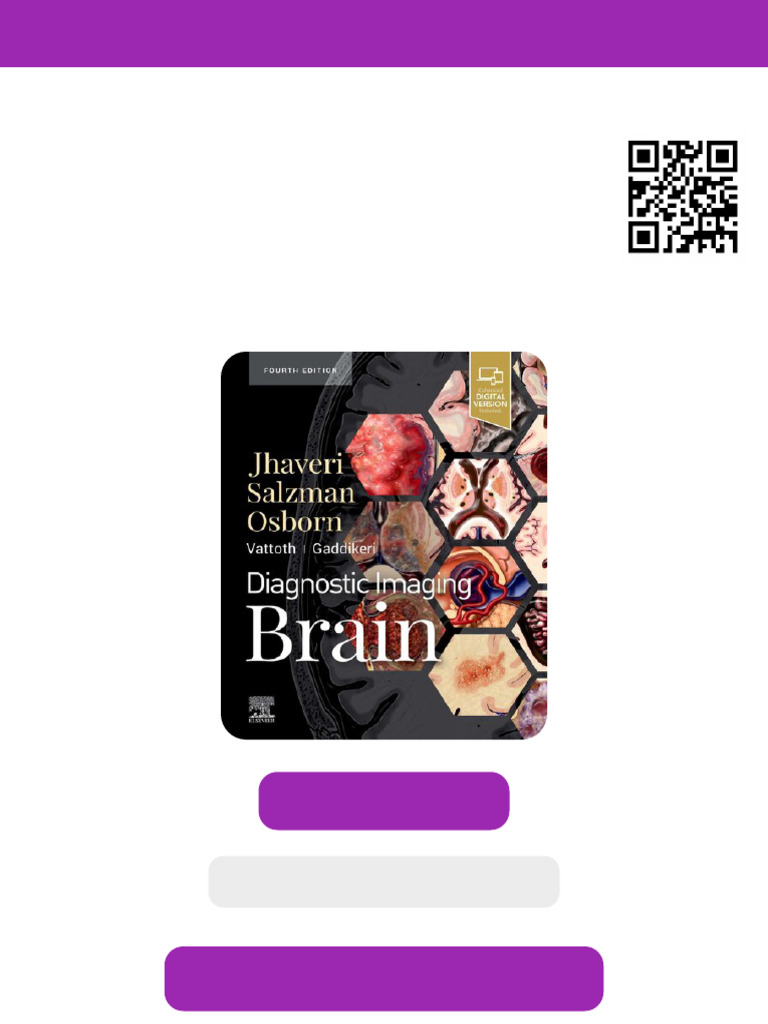 Diagnostic Imaging: Brain Miral D. Jhaveri Ebook Instant PDF | PDF