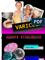 VARICELA