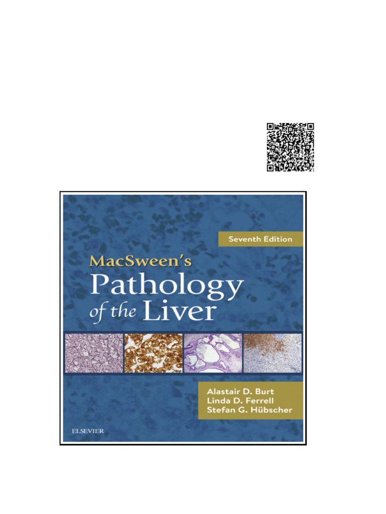 MacSween's Pathology of The Liver 7th | PDF | Premier League | Burial