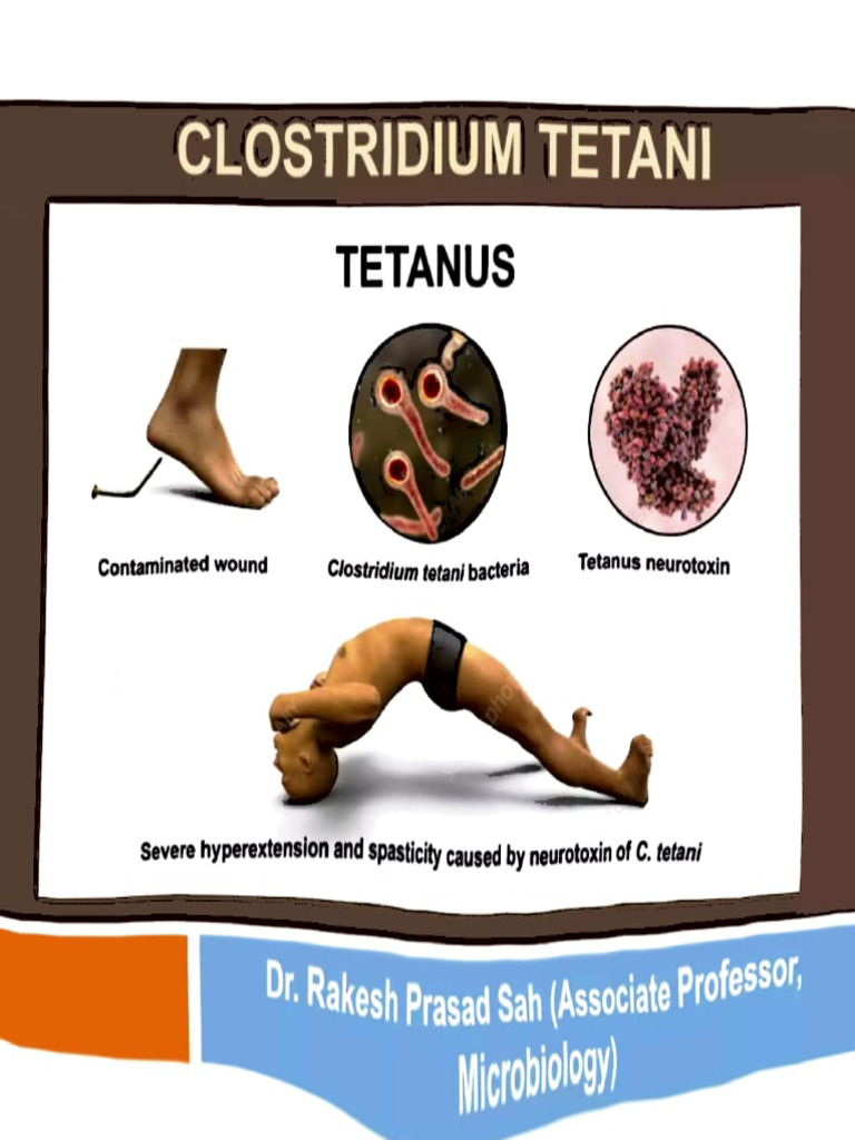 Tetanus Lecture | PDF
