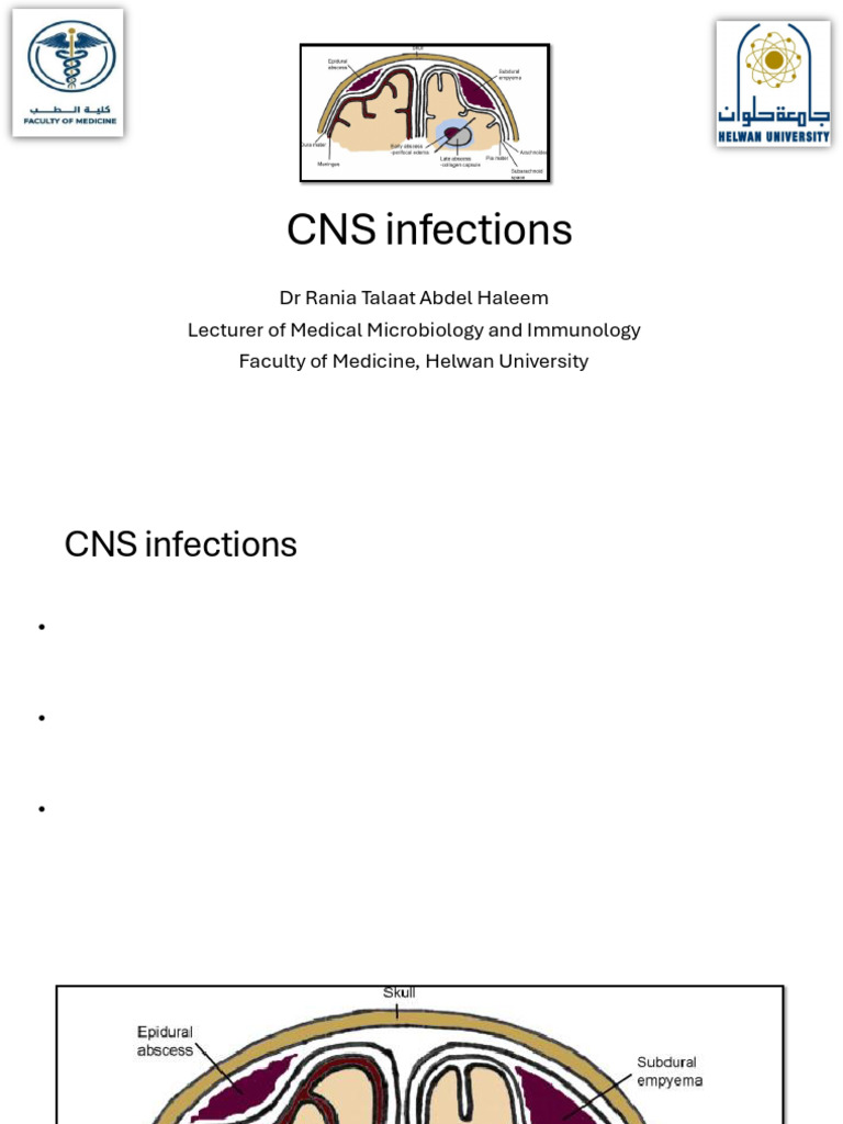 CNS Infections Neuroscience | PDF | Meningitis | Infection