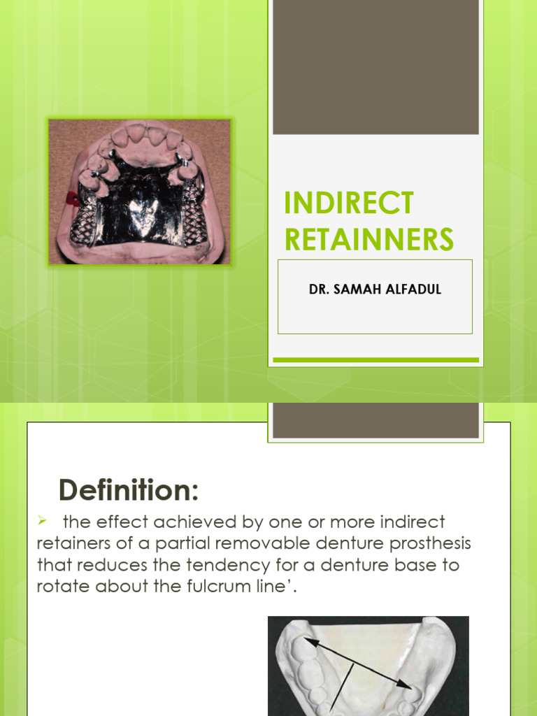 Indirect Retainers | PDF | Mouth | Dental Anatomy