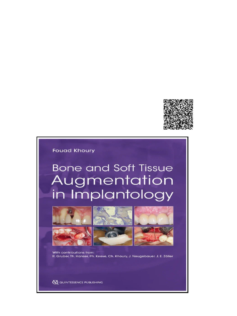 Bone and Soft Tissue Augmentation in Implantology 1st Edition Fouad ...