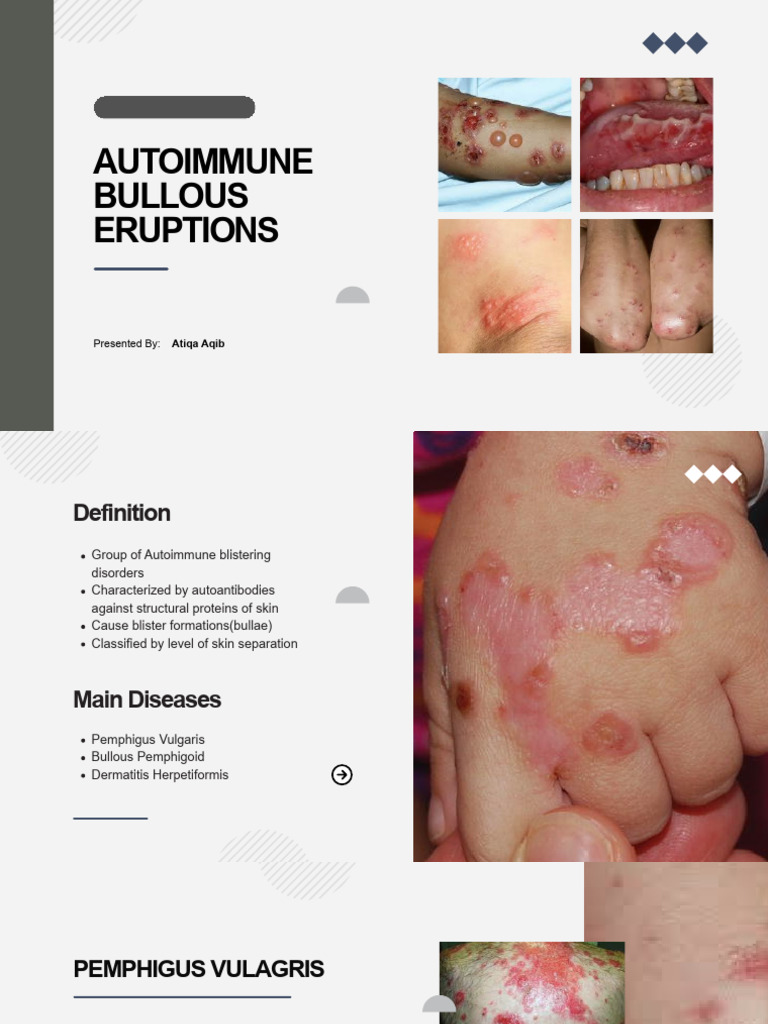 Autoimmune Bullous Eruptions | PDF | Medical Specialties | Skin