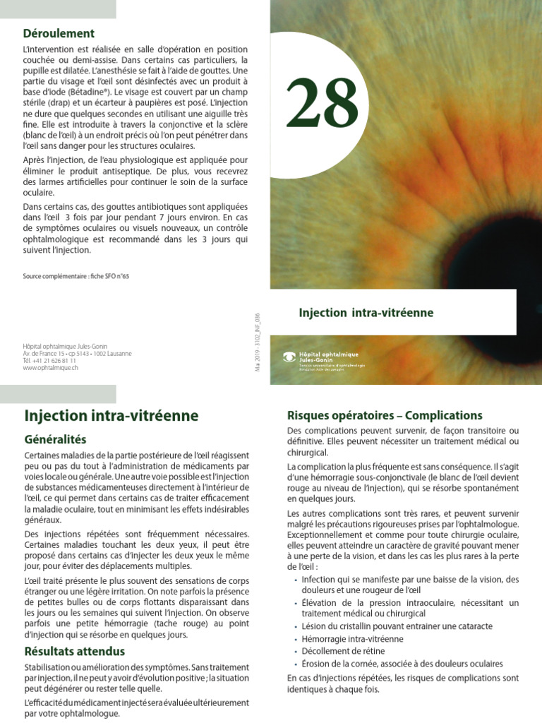 Injection Intra Vitreenne | PDF | Médecine clinique | Spécialités médicales
