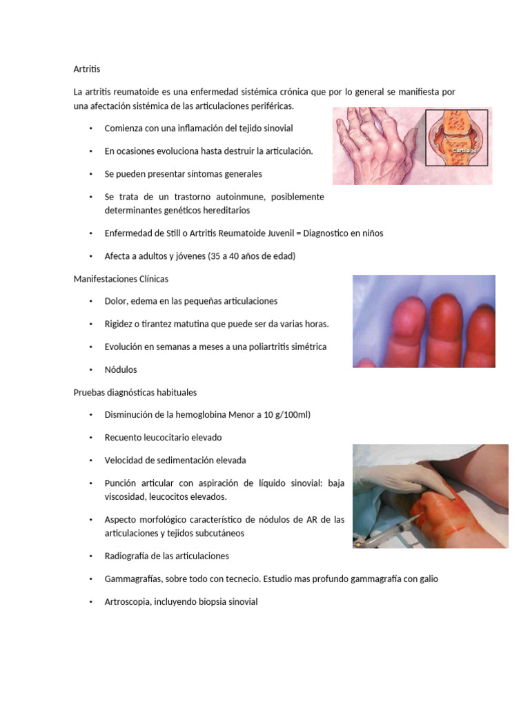 Art Ritis | PDF | Artritis Reumatoide | Artritis