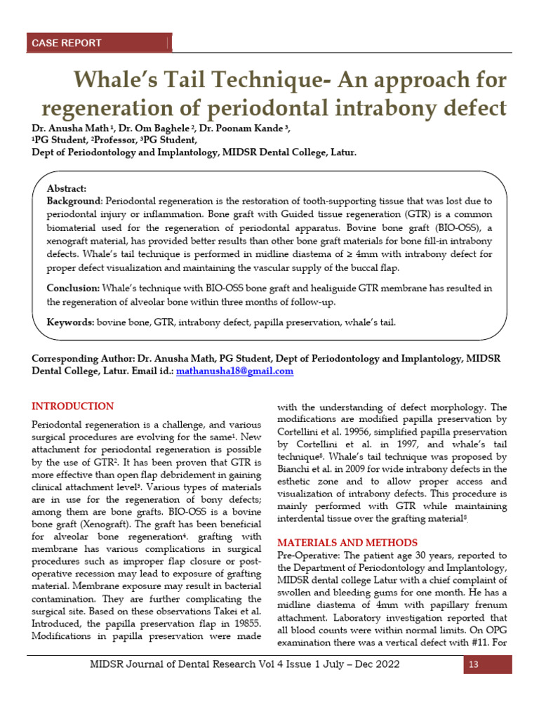 Whale's Tail Technique An Approach For Regeneration of Periodontal ...