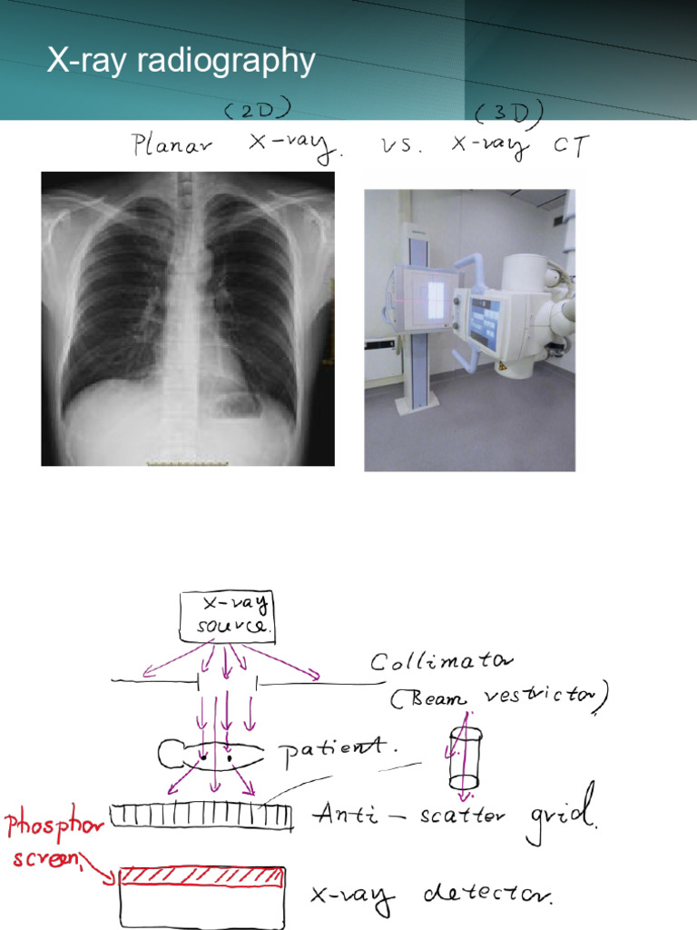 X-Ray Slides - 2026W - W - Notes | PDF