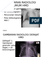 Gambaran Radiologi Umum Hmd