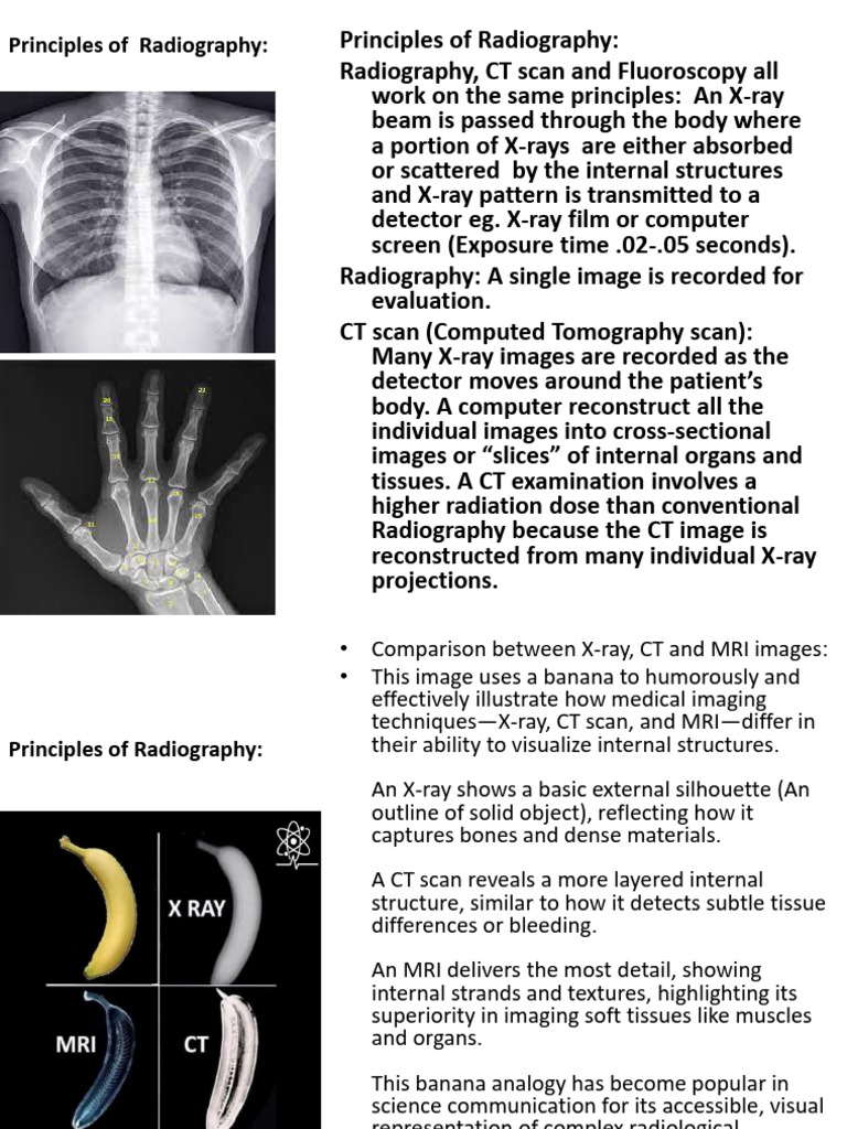 New Ppt-17 Unit-1 Principles of Radiography | PDF | Radiography | Ct Scan